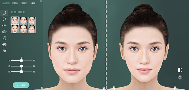 什么是數(shù)字3D整形？